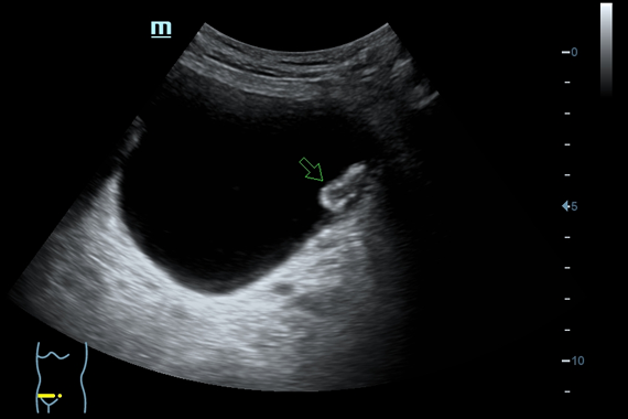Mindray DC-60 Exp X-Insight