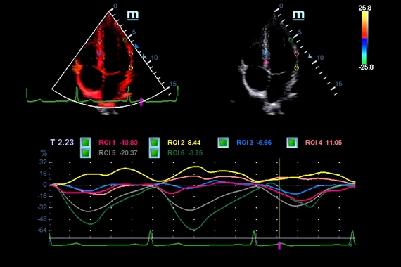 Mindray DC-70 pro X-Insight