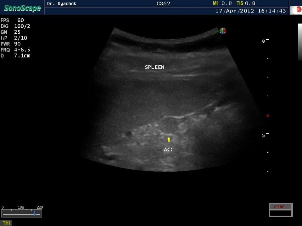 SonoScape S20Exp vet