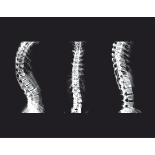 Рентгеновский костный денситометр GE Lunar iDXA