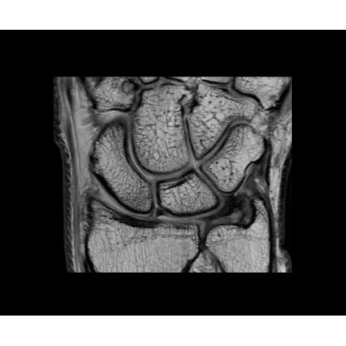 МРТ аппарат GE SIGNA PET/MR 3.0T