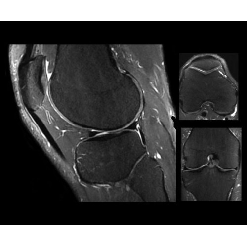 МРТ аппарат GE SIGNA PET/MR 3.0T