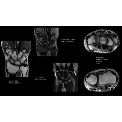 МРТ аппарат GE SIGNA Voyager 1.5T